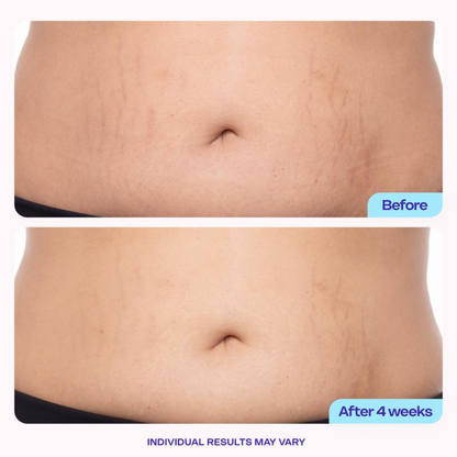 Tighten & Smooth Belly Firming Cream